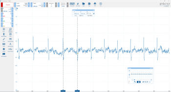 Human heartbeat captured on PicoScope 4444